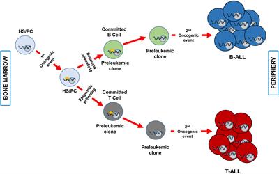 Epigenetic Priming in Childhood Acute Lymphoblastic Leukemia